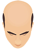 Baldness Stages 5
