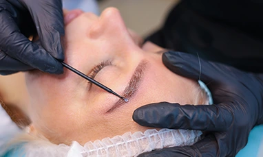 Eyebrow Transplant