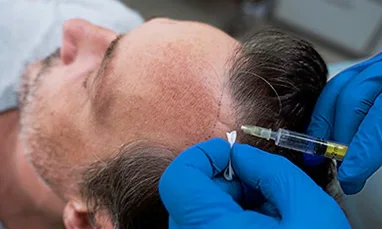 Scalp Rejuvenation Therapy